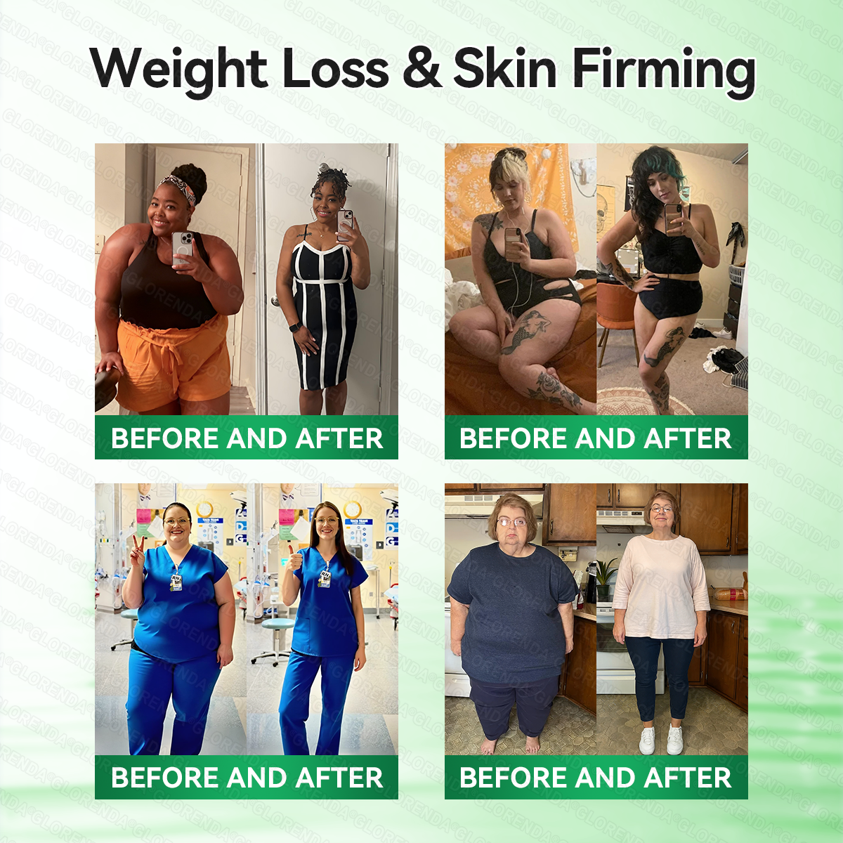 🇿🇦𝑶𝒇𝒇𝒊𝒄𝒊𝒂𝒍 𝑺𝒕𝒐𝒓𝒆 | 🌺🌺𝐆𝑳𝑶𝗥𝗘𝗡𝘿𝘼® 𝙈𝒐𝒓𝒊𝒏𝒈𝗮 · 𝗕𝗲𝗿𝗯𝐞𝐫𝐢𝐧𝙚 × 𝙉𝑨𝑫+ 𝟏𝟎-𝙞𝙣-1 𝘼𝒅𝒗𝒂𝒏𝒄𝒆𝐝 𝐍𝐚𝐧𝙤 𝙈𝙞𝙘𝙧𝙤𝙣𝒆𝒆𝒅𝒍𝐞 𝐏𝐚𝐭𝙘𝙝(𝐉𝐮𝐬𝐭 𝐨𝐧𝐜𝐞 𝐚 𝐝𝐚𝐲, 𝐯𝐢𝐬𝐢𝐛𝐥𝐞 𝐜𝐡𝐚𝐧𝐠𝐞𝐬 𝐢𝐧 𝟕 𝐝𝐚𝐲𝐬） ✅ 𝐅𝐨𝐫 𝐨𝐛𝐞𝐬𝐢𝐭𝐲, 🅛🅞🅞🅢🅔 🅢🅚🅘🅝,𝐝𝐢𝐚𝐛𝐞𝐭𝐞𝐬, 𝐬𝐥𝐞𝐞𝐩 𝐚𝐩𝐧𝐞𝐚, 𝐣𝐨𝐢𝐧𝐭 𝐢𝐬𝐬𝐮𝐞𝐬, 𝐚𝐧𝐝 𝐦𝐨𝐫𝐞🎀
